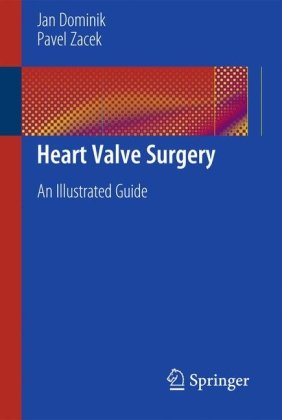Heart Valve Surgery An Illustrated Guide 1st Edition Jan Dominik