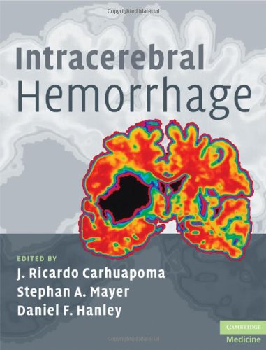 Intracerebral Hemorrhage 1st Edition J Ricardo Carhuapoma Stephan A Mayer