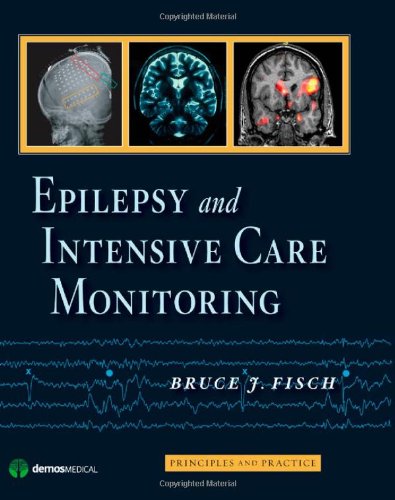 Epilepsy And Intensive Care Monitoring Principles And Practice 1st Edition Bruce J Fisch