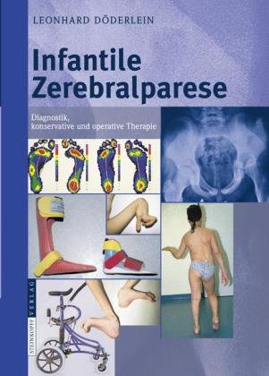 Infantile Zerebralparese Diagnostik Konservative Und Operative Therapie 1st Edition L Dderlein