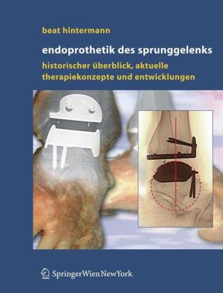 Endoprothetik Des Sprunggelenks Historischer Berblick Aktuelle Therapiekonzepte Und Entwicklungen 1 A Beat Hintermann