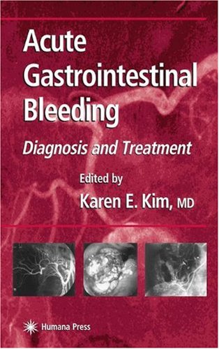 Acute Gastrointestinal Bleeding Diagnosis And Treatment 1st Edition Karen E Kim