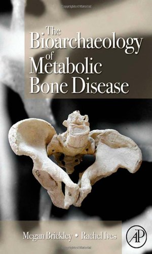 The Bioarchaeology Of Metabolic Bone Disease 1st Edition Megan Brickley