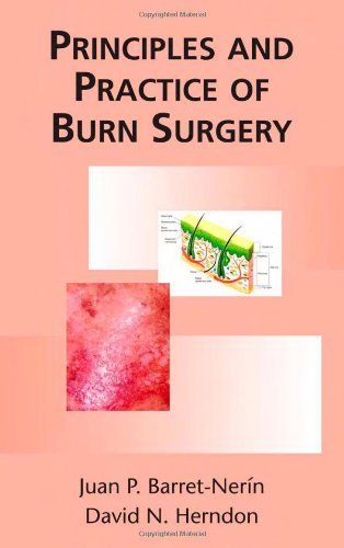 Principles And Practice Of Burn Surgery 1st Edition Juan Barretnerin