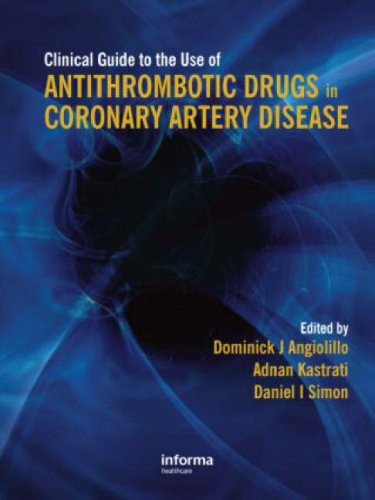 Clinical Guide To The Use Of Antithrombotic Drugs In Coronary Artery Disease 1st Edition Angiolillo Dominick