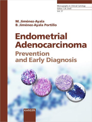 Endometrial Adenocarcinoma Prevention And Early Diagnosis 1st Edition Matias Jimenezayala