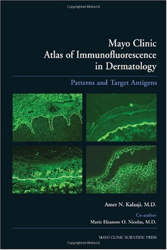 Mayo Clinic Atlas Of Immunofluorescence In Dermatology Patterns And Target Antigens 1st Edition N Kalaaji Amer