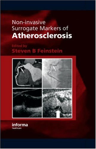 Noninvasive Surrogate Markers Of Atherosclerosis 1st Edition B Feinstein Steven
