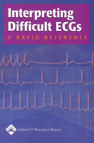 Interpreting Difficult Ecgs A Rapid Reference 1st Edition Springhouse