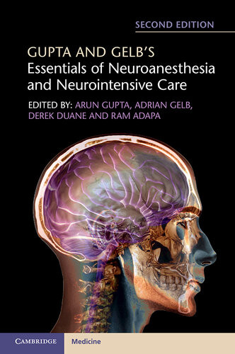 Gupta And Gelbs Essentials Of Neuroanesthesia And Neurointensive Care 2nd Edition Arun Gupta