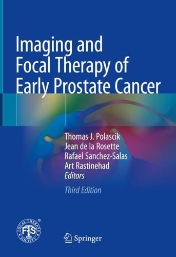 Imaging And Focal Therapy Of Early Prostate Cancer 3rd 1st Edition Thomas J Polascik