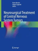 Neurosurgical Treatment Of Central Nervous System Tumors Pietro Mortini