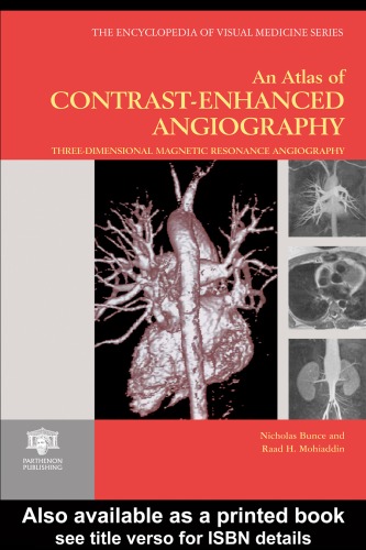 An Atlas Of Contrastenhanced Angiography Nicholas Bunce