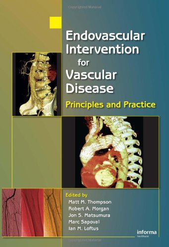Endovascular Intervention For Vascular Disease Principles And Practice 1st Edition Jon Matsumura