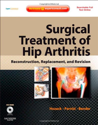 Surgical Treatment Of Hip Arthritis Reconstruction Replacement And Revision Expert Consult Online And Print With Dvd 1 Hardvd William J Hozack