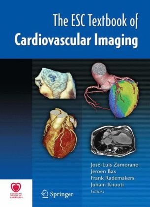 The Esc Textbook Of Cardiovascular Imaging 1st Edition Miguel Angel Garcafernndez