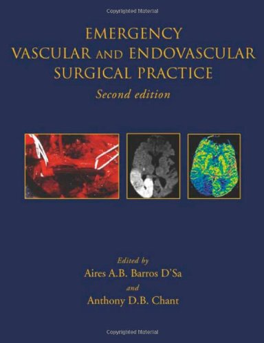 Emergency Vascular And Endovascular Surgical Practice 2nd Edition Aires A B Barros Dsa