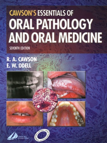 Cawsons Essentials Of Oral Pathology And Oral Medicine 7th Edition R A Cawson
