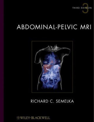 Abdominalpelvic Mri 3rd Edition Richard C Semelka