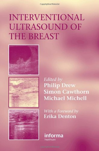 Interventional Ultrasound Of The Breast 1st Edition Drew Philip