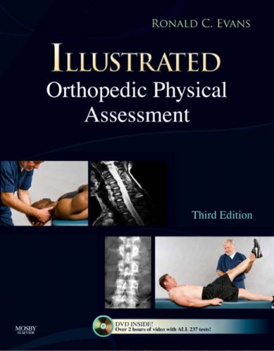 Illustrated Orthopedic Physical Assessment 3rd Ronald C Evans