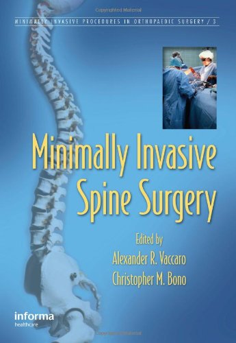 Minimally Invasive Spine Surgery 1st Edition R Vaccaro Alexander
