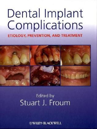 Dental Implant Complications Etiology Prevention And Treatment 1st Edition Stuart J Froum