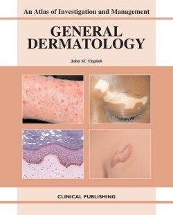 General Dermatology An Atlas Of Investigation And Management 1st Edition John S C English