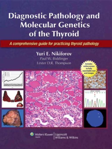 Diagnostic Pathology And Molecular Genetics Of The Thyroid A Comprehensive Guide For Practicing Thyroid Pathology 1 Harpsc Yuri E Nikiforov
