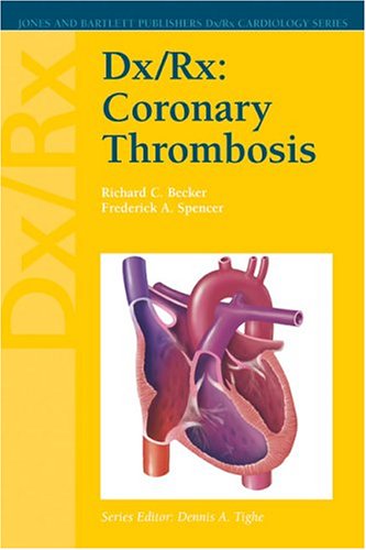 Dxrx Coronary Thrombosis 1st Edition Richard C Becker Frederick A Spencer