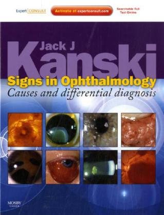 Signs In Ophthalmology Causes And Differential Diagnosis Expert Consult Online And Print Harpsc Jack J Kanski Md Ms Frcs Frcophth