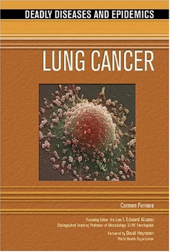 Lung Cancer 1st Edition Carmen Ferreiro I Edward Alcamo
