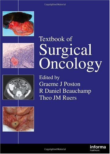 Textbook Of Surgical Oncology 1st Edition J Poston Graeme Daniel Beauchamp