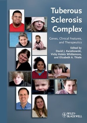Tuberous Sclerosis Complex Genes Clinical Features And Therapeutics 1st Edition David J Kwiatkowski