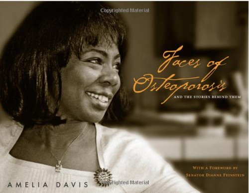 Faces Of Osteoporosis And The Stories Behind Them 1st Edition Amelia Davis
