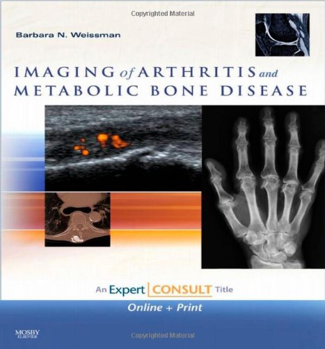 Imaging Of Arthritis And Metabolic Bone Disease Expert Consult Online And Print 1 Harpsc Barbara N W Weissman Md