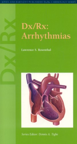 Dxrx Arrhythmias 1st Edition Lawrence Rosenthal