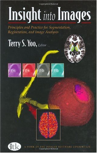 Insight Into Images Principles And Practice For Segmentation Registration And Image Analysis 1st Edition Terry S Yoo
