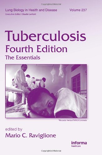 Tuberculosis The Essentials Fourth Edition 4th Edition Mario C Raviglione