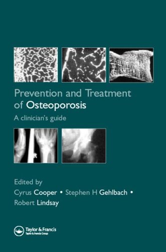 Prevention And Treatment Of Osteoporosis In The Highrisk Patient A Clinicians Guide 1st Edition Cyrus Cooper