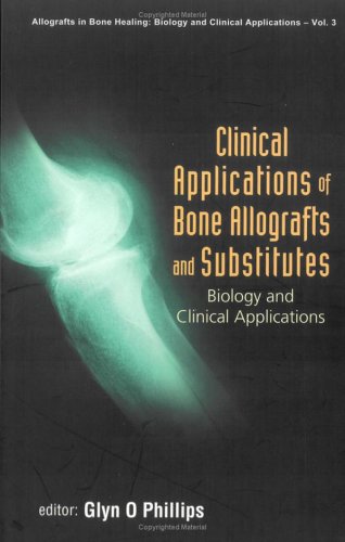 Clinical Applications Of Bones Allografts And Substitutes Glyn O Phillips
