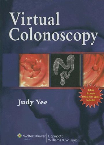 Virtual Colonoscopy 1 Harpsc Judy Yee