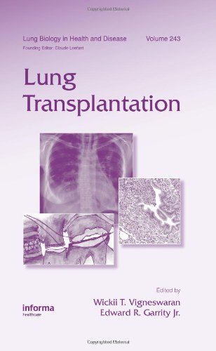 Lung Transplantation 1st Edition Wickii Vigneswaran Edward Garrity