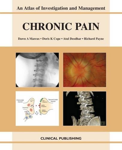 Chronic Pain Atlas Of Investigation And Management 1st Edition Dawn A Marcus