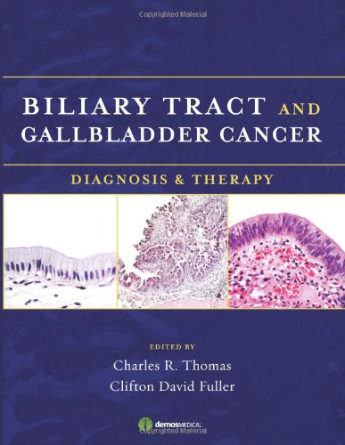 Biliary Tract And Gallbladder Cancer Diagnosis Therapy 1st Edition Charles Thomas