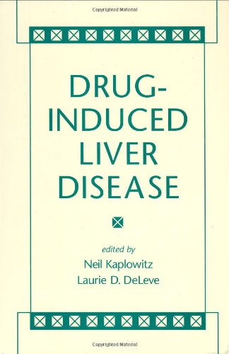Druginduced Liver Disease 2nd Edition 1st Edition Neil Kaplowitz
