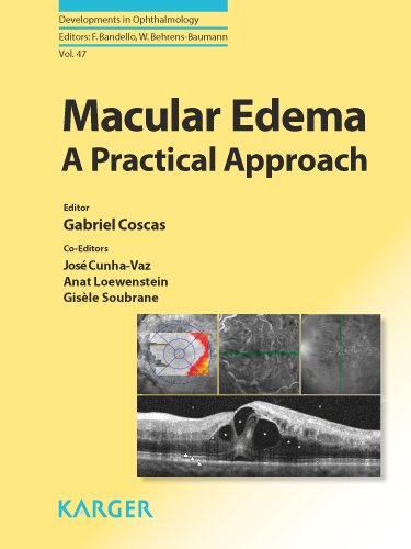 Macular Edema A Practical Approach Developments In Ophthalmology 1st Edition G Coscas