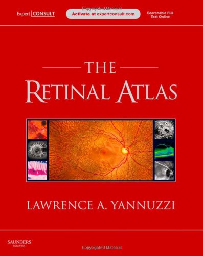 The Retinal Atlas Expert Consult Online And Print Harpsc Lawrence A Yannuzzi Md