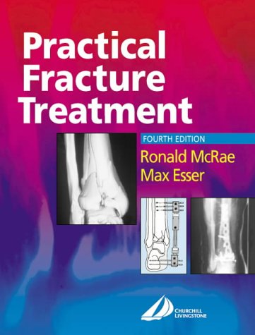 Practical Fracture Treatment 4th Edition 4th Ronald Mcrae Max Esser