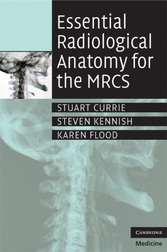 Essential Radiological Anatomy For The Mrcs 1st Edition Stuart Currie Bsc Mb Chb Mrcs